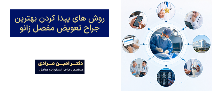 روش های پیدا کردن بهترین جراح تعویض مفصل زانو
